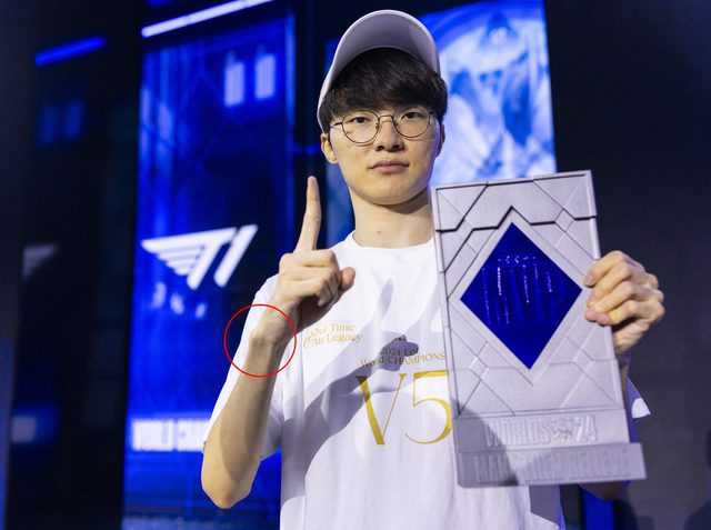 Faker's Wrist Joint is Prominent